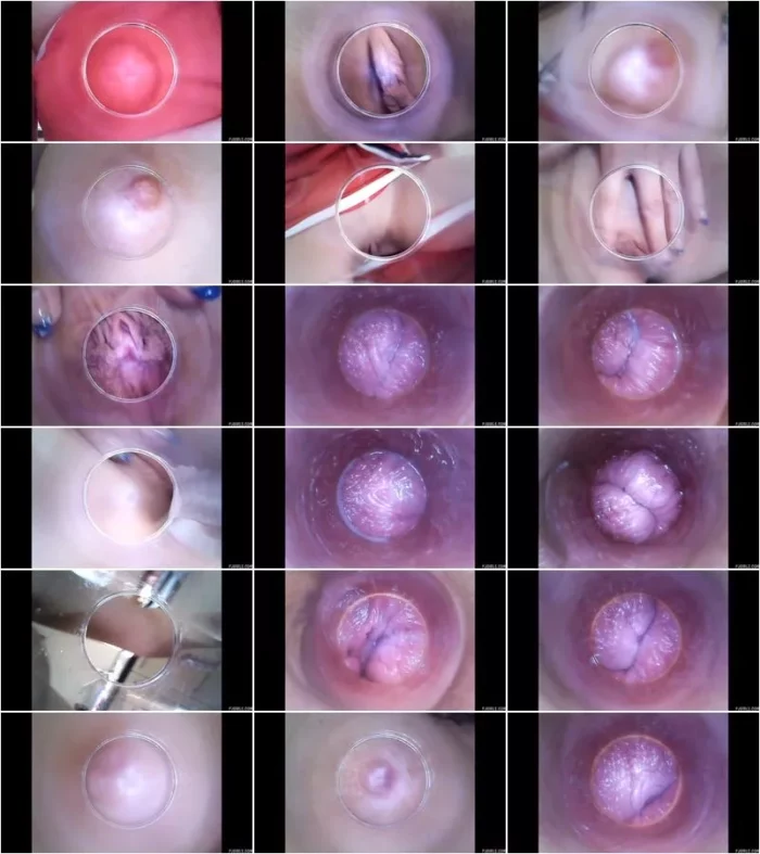 Timea Bella - 2016-02-13 - RAW endoscopic video (BONUS) [HD 720p] (Pj Girls)