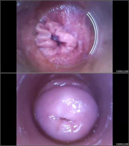 Angel Piaff - 2016-07-17 - RAW endoscopic video (BONUS) [HD 720p] (Pj Girls)