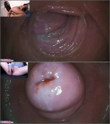 Julia Parker, Sydney Love, Elizabeth - Raw Endoscopic Bonus (BONUS) 17.05.2020 [FullHD 1080p] (Pj Girls)