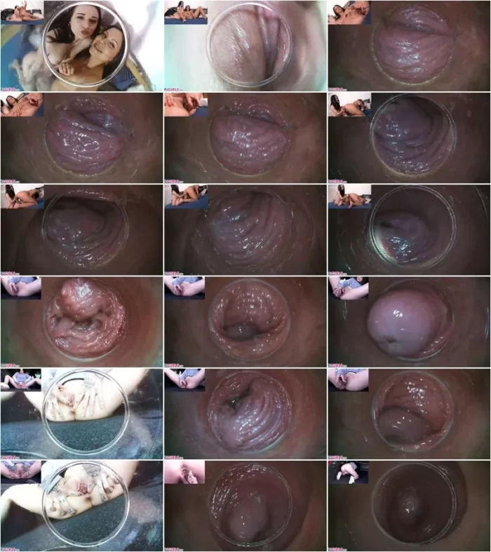 Julia Parker, Sydney Love, Elizabeth - Raw Endoscopic Bonus (BONUS) 17.05.2020 [FullHD 1080p] (Pj Girls)