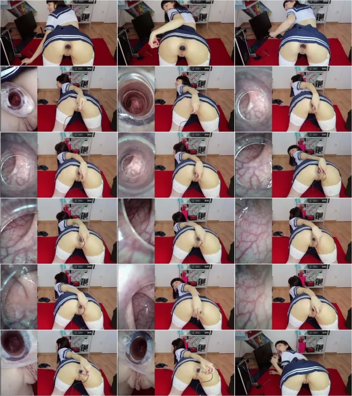 Mylene - CUSTOM: Hot endoscope asshole inspection - 22.08.2018 [FullHD 1080p] (ManyVids)