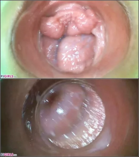 Silvia Black - Raw Endoscopic Video (14.08.2021) [FullHD 1080p] (Pj Girls)