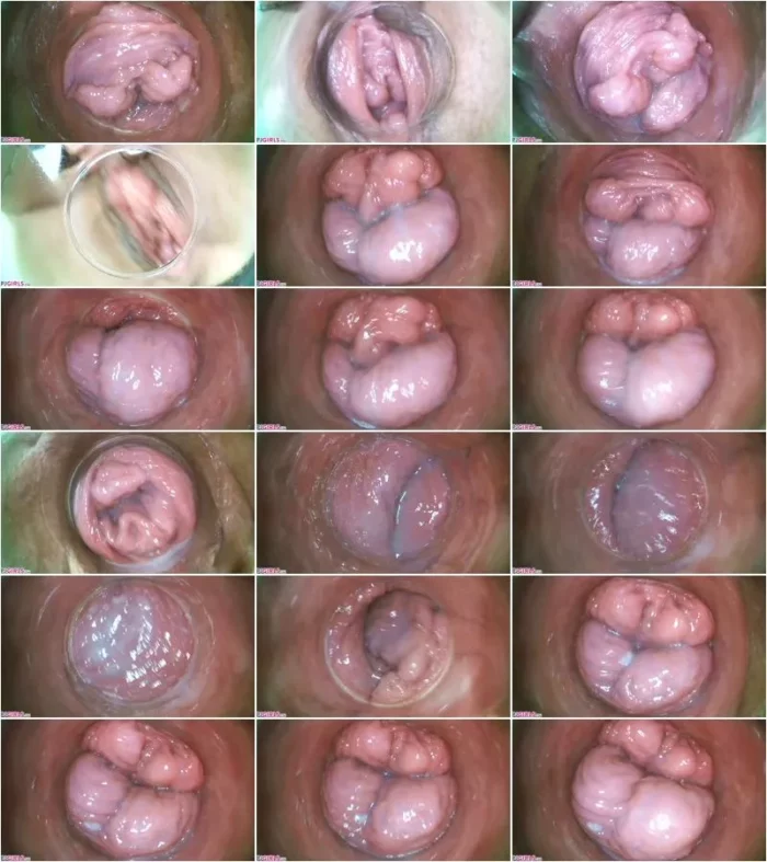 Silvia Black - Raw Endoscopic Video (14.08.2021) [FullHD 1080p] (Pj Girls)