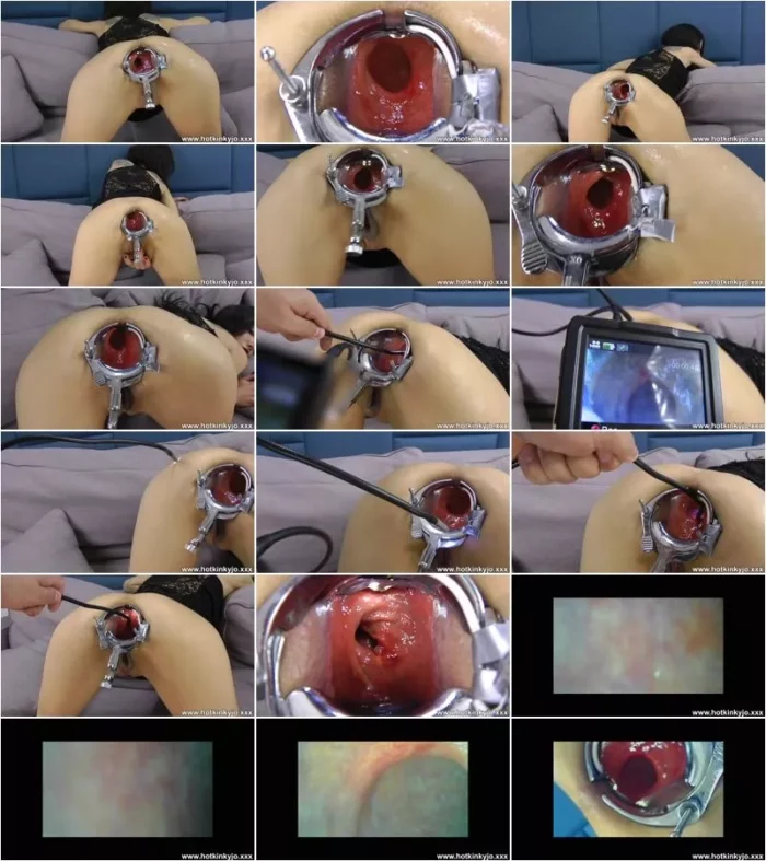Hotkinkyjo - Hotkinkyjo XO speculum and deep anal abbys travel with endoscope camera 04.12.2022 [FullHD 1080p] (Dildo)