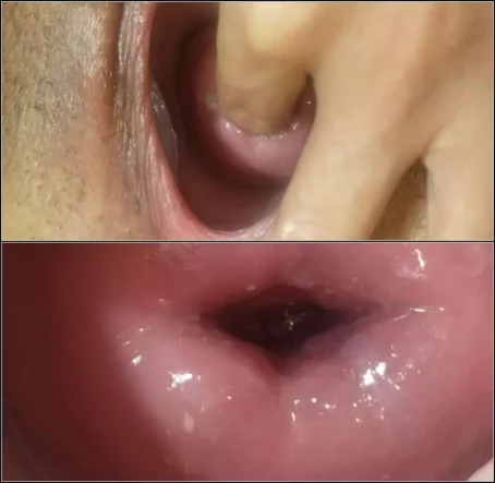 Alisson_Punk - Salchicha cervix extrem [2K 1080p] (Dildo)