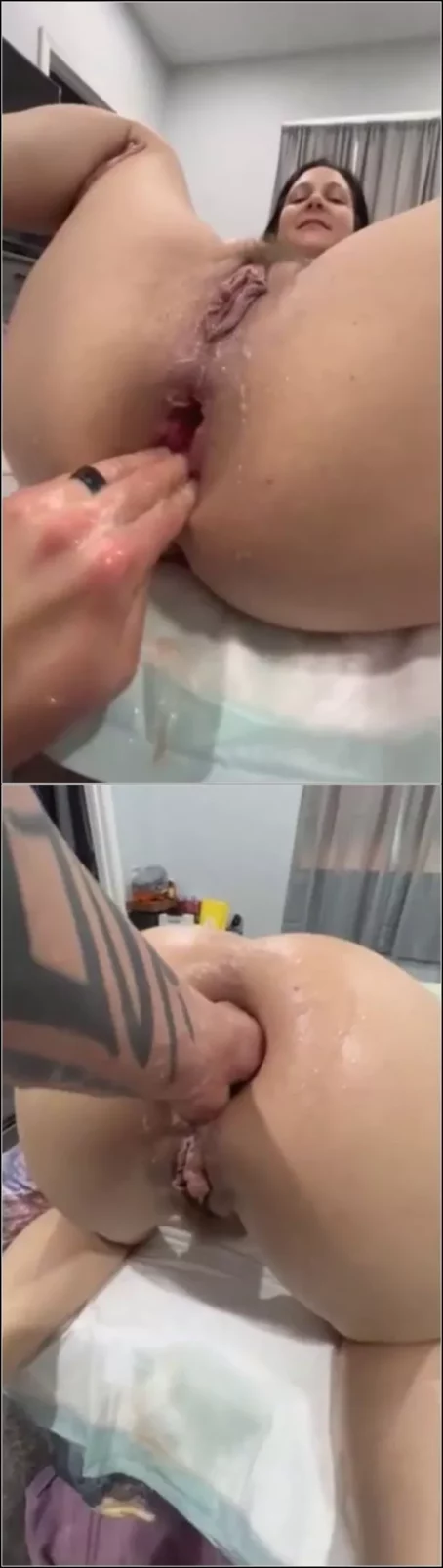 Trudy - Fisting her anal prolapse 19.03.2026 [SD 1080p] (Sicflics)