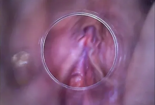 Izzy Delphine, Nathaly – 2016-02-08 – RAW endoscopic video (BONUS) [HD 720p] (Pj Girls)