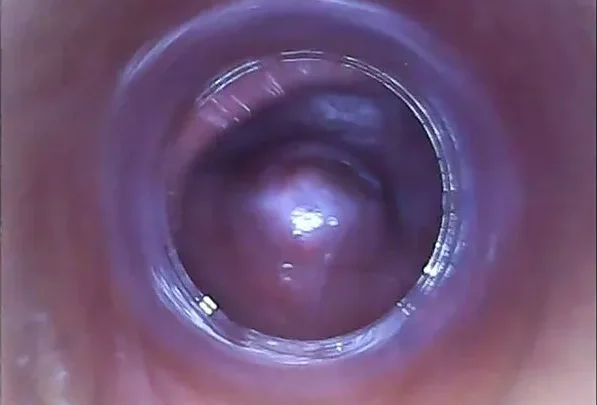 Screenshot 1 from Izzy Delphine, Nathaly – 2016-02-08 – RAW endoscopic video (BONUS) [HD 720p] (Pj Girls)