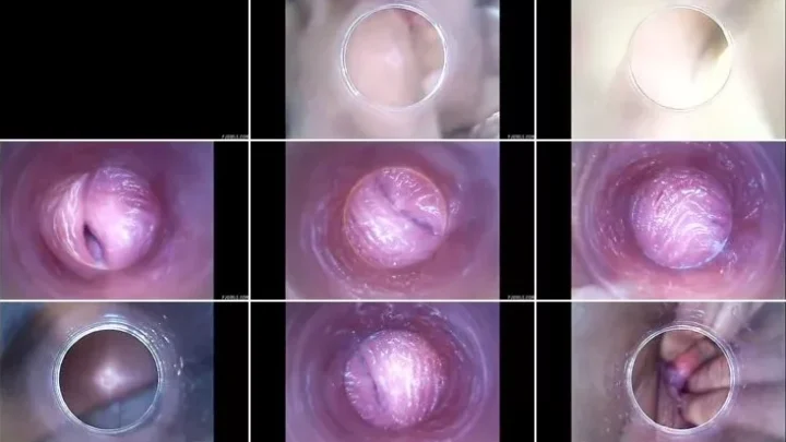 Screenshot 2 from Lexi Dona, Vanda – 2016-05-29 – RAW endoscopic video (BONUS) [HD 720p] (Pj Girls)