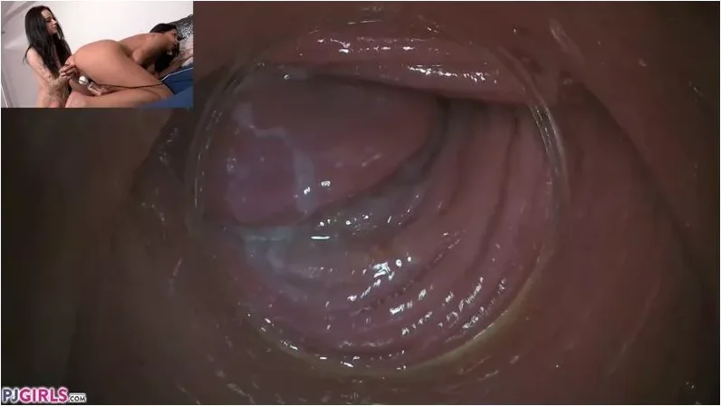 Play video: Julia Parker, Sydney Love, Elizabeth – Raw Endoscopic Bonus (BONUS) 17.05.2020 [FullHD 1080p] (Pj Girls)