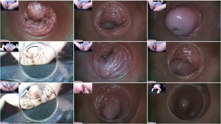 Screenshot 3 from Julia Parker, Sydney Love, Elizabeth – Raw Endoscopic Bonus (BONUS) 17.05.2020 [FullHD 1080p] (Pj Girls)